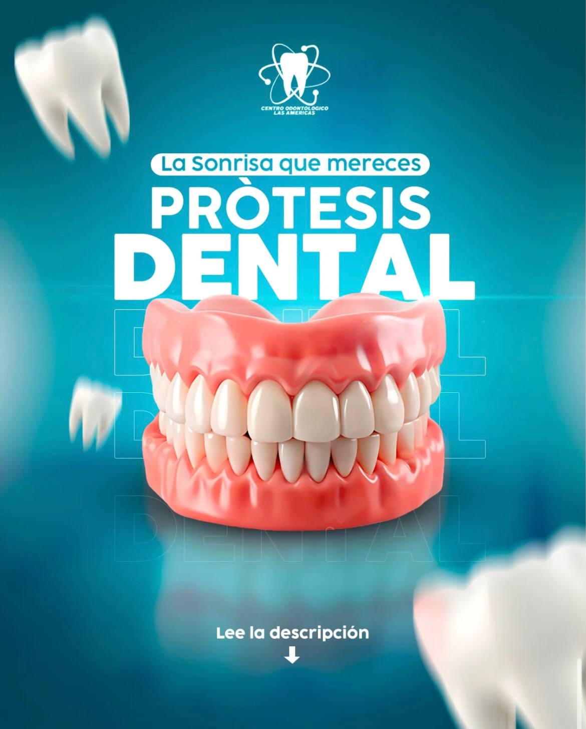 Prótesis Dental